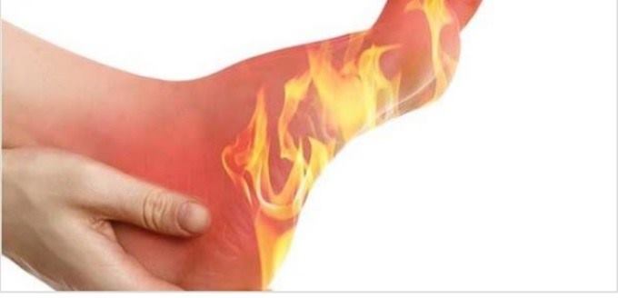 الشوكة العظمية .. كل ما تريده عن طريقة علاج آلام القدم