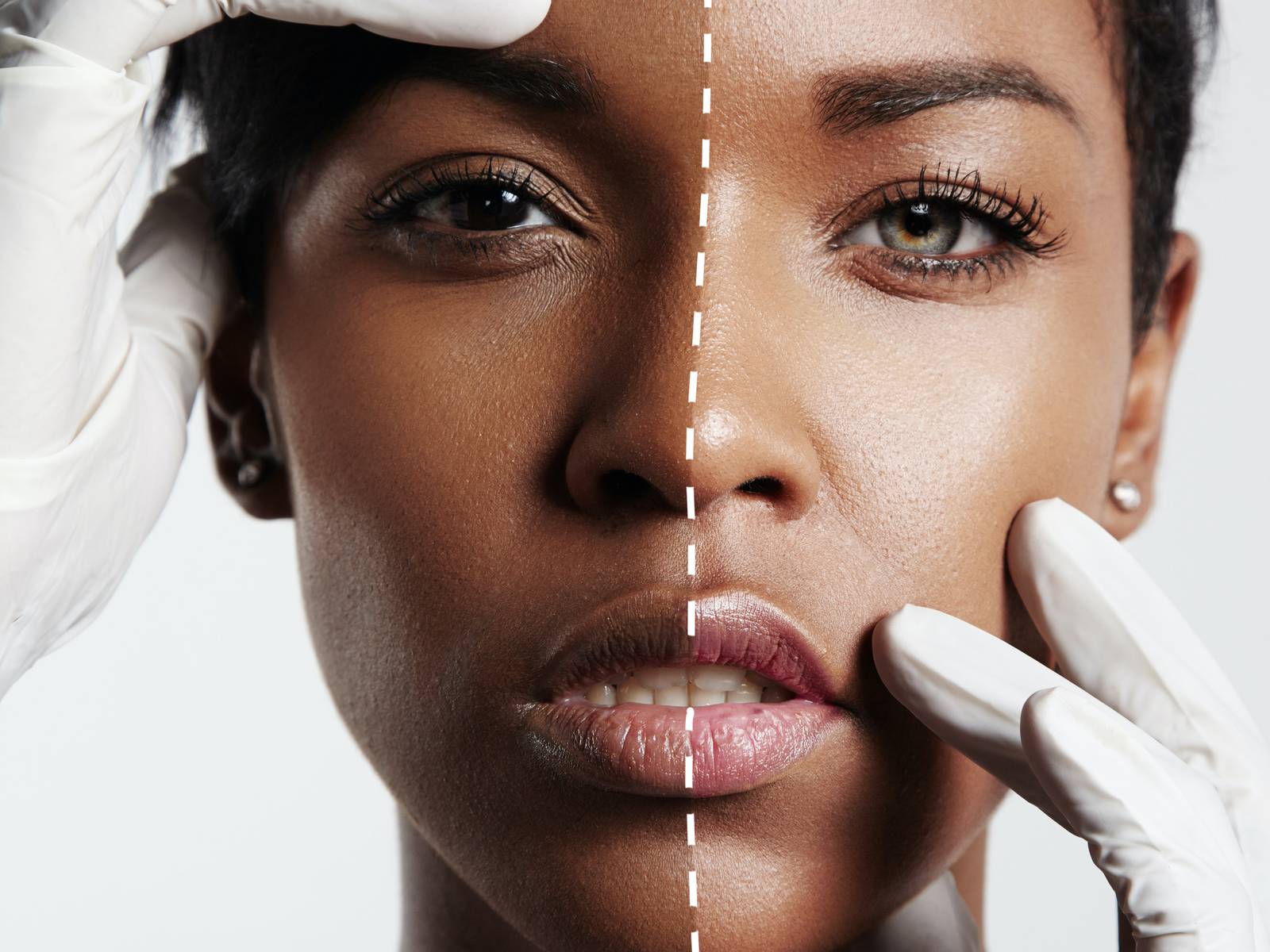 تفتيح البشرة 