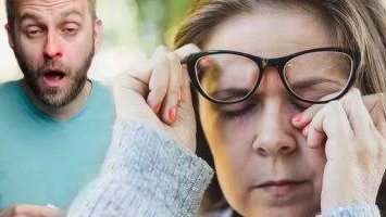 أعرض نقص فيتامين د