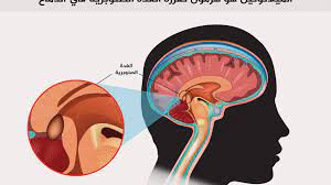 الغدة الصنوبرية