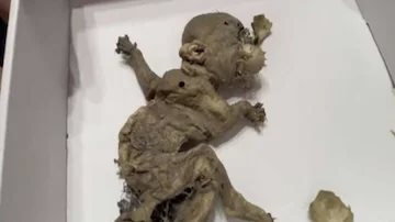 ابن الجن.. اكتشاف جنين يشبه العفريت داخل مستودع مهجور بالمكس