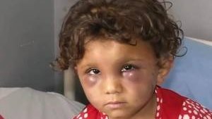 الطفلة السورية جوري 