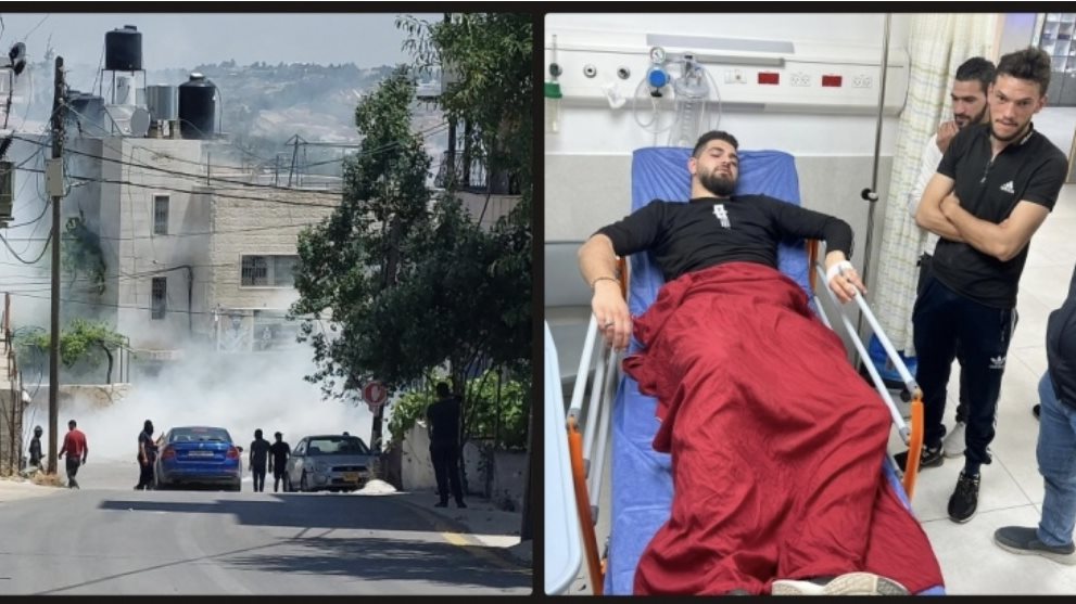 إصابة مصور صحفي برصاص الاحتلال  في بيت أمر
