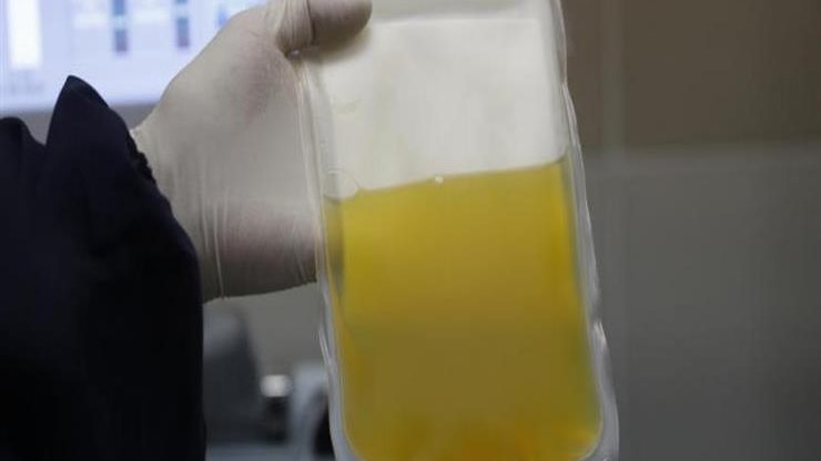 بلازما الدم