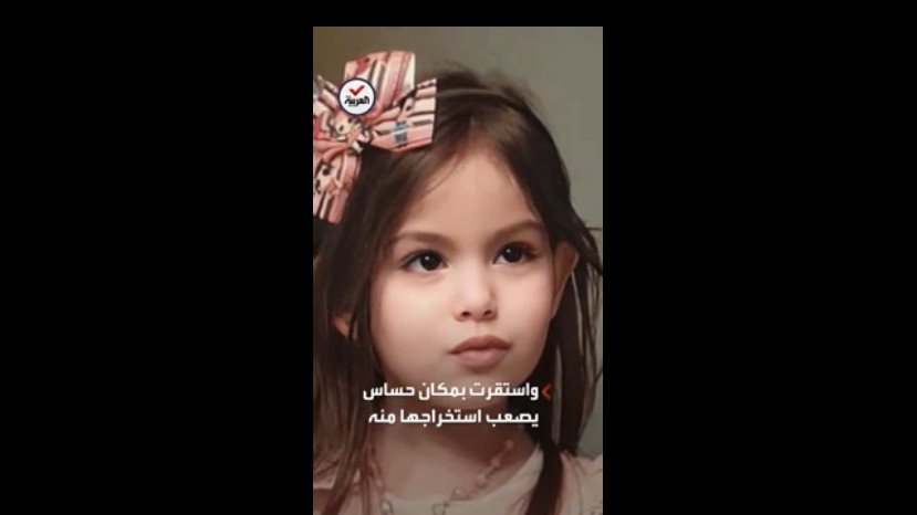 طفلة لبنانية تدخل في غيبوبة بسبب رصاصة طائشة