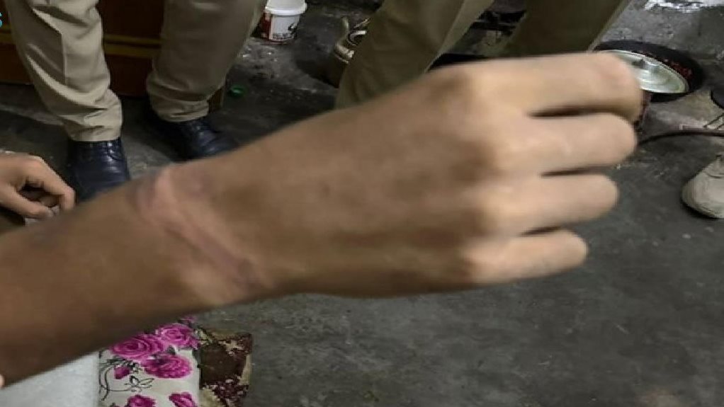 آثار تقييد الاب بالسلاسل