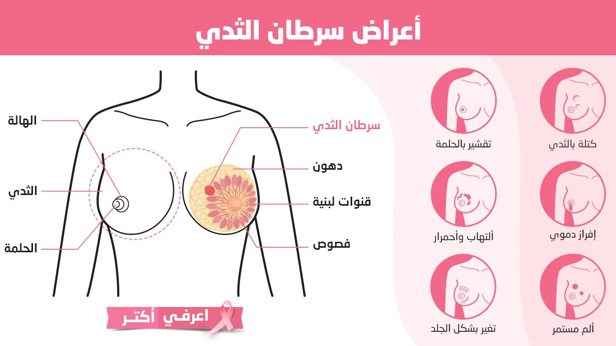 فحص سرطان الثدي في المنزل