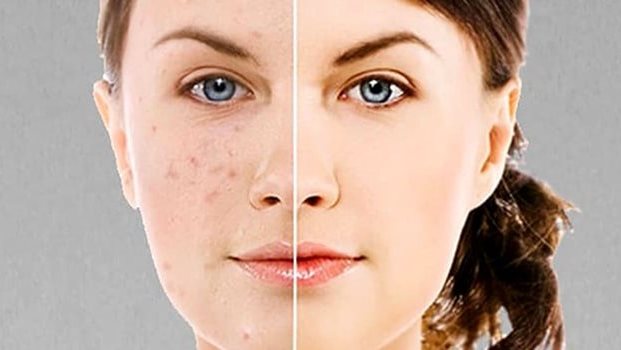 ماسك لتفتيح البشره 