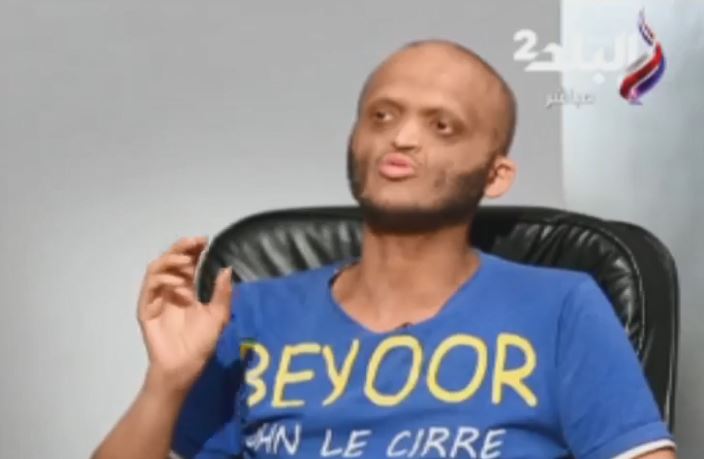 الشيخوخة المبكرة