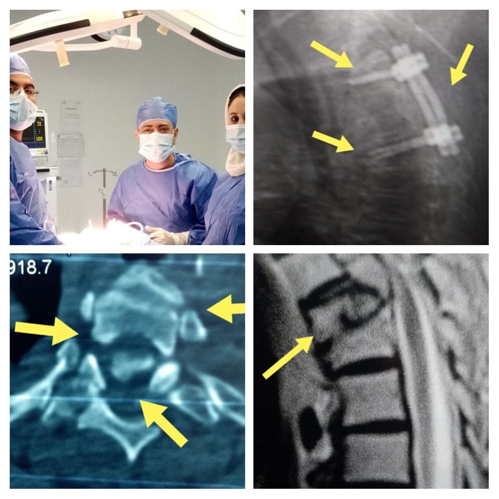 جانب من الجراحة