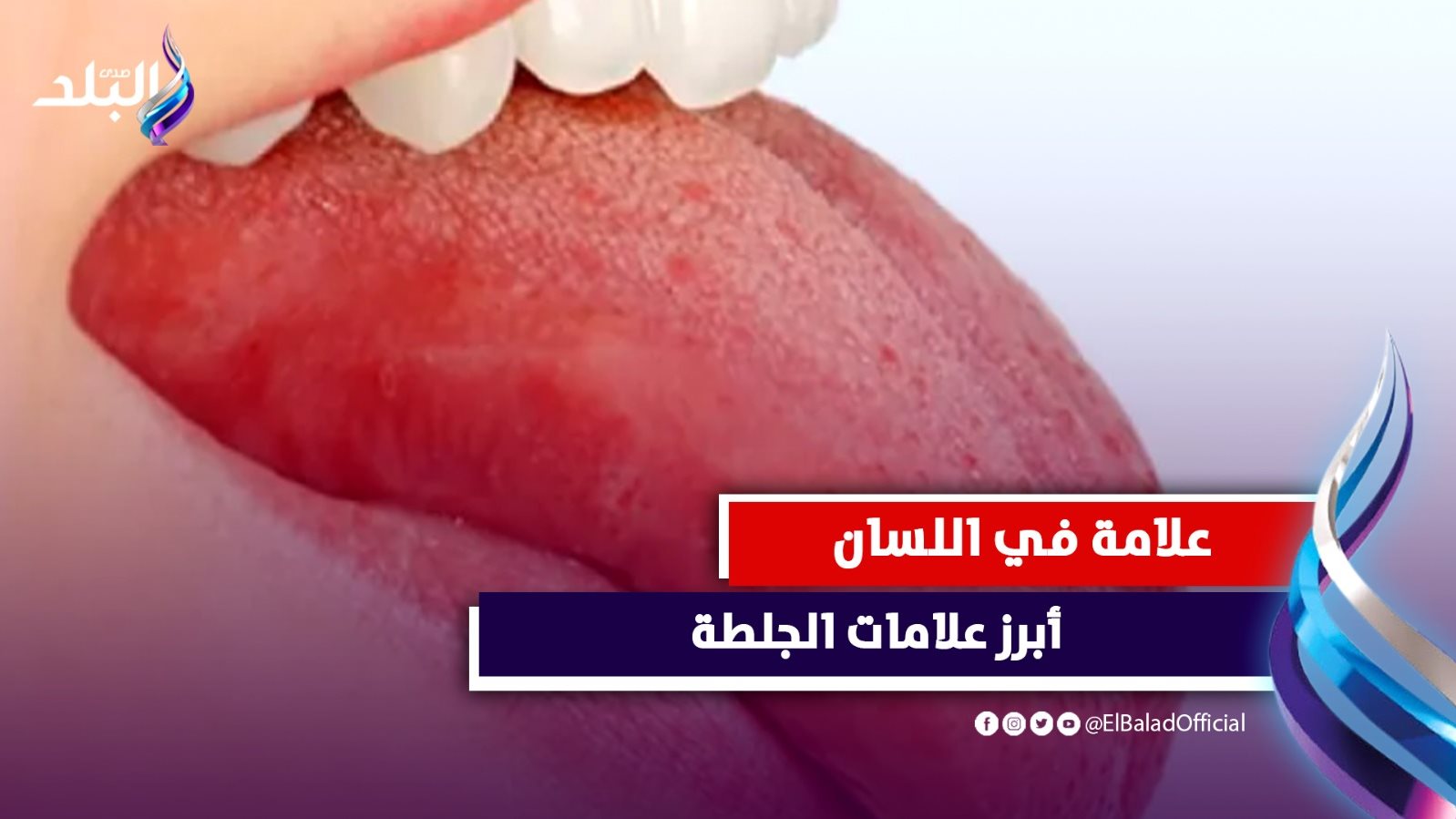 علامات فى اللسان تكشف حدوث جلطة