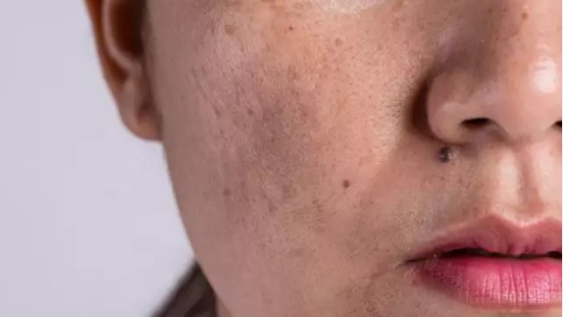 علاج الجلد والبشرة