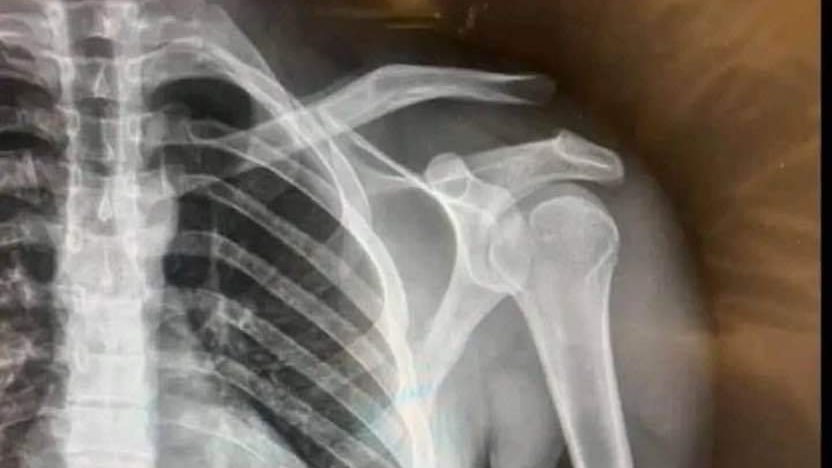 إصابة إمام عاشور