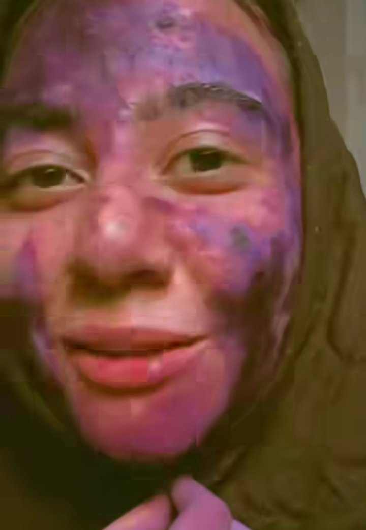 شكل حبيبة النجار خلال المرض