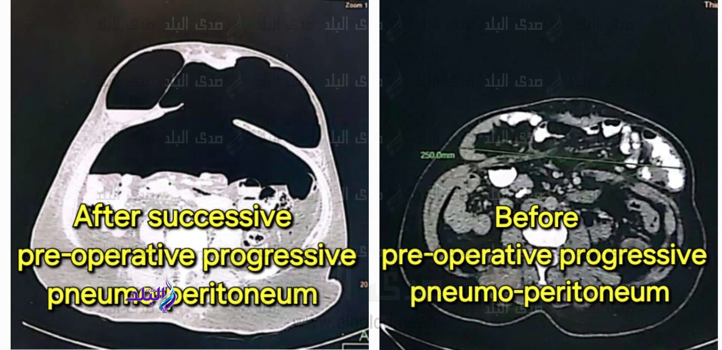 مستشفى قنا العام 