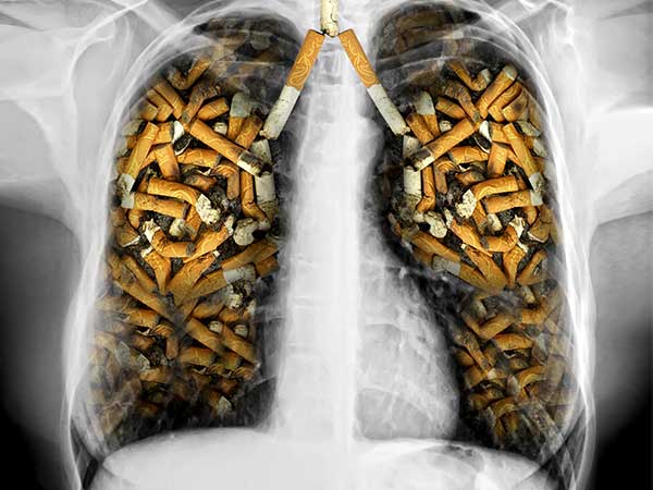 «حتي لو بدخن».. 7 أطعمة لتنظيف الرئة وطرد السموم م