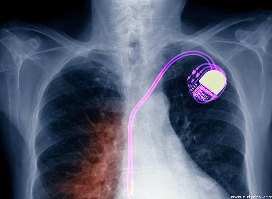 صورة ارشيفية