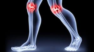 «تعاني من آلام المفاصل» .. 9 أطعمة تعرضك للخطر