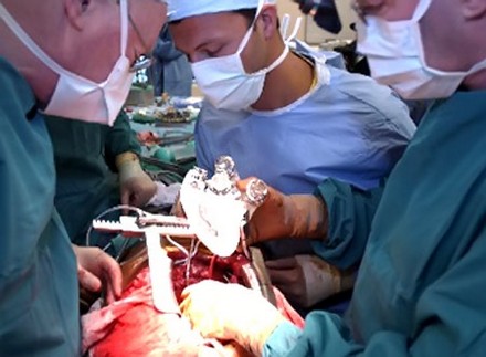 تجارة الأعضاء - صورة أرشيفية