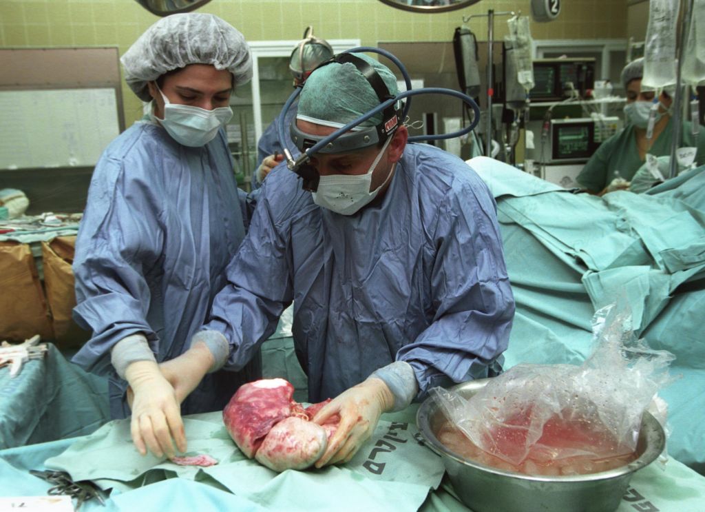 تجارة الأعضاء - صورة تعبيرية