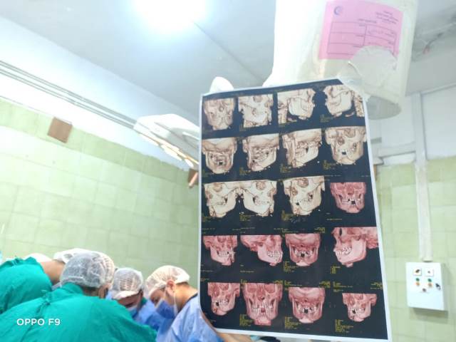 إجراء جراحة متقدمة للوجه والفكين والعظام بمستشفي فاقوس 