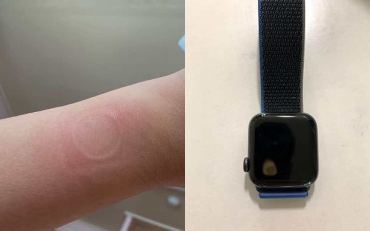 مشكلة كبرى بـ ساعة آبل الذكية Apple Watch SE