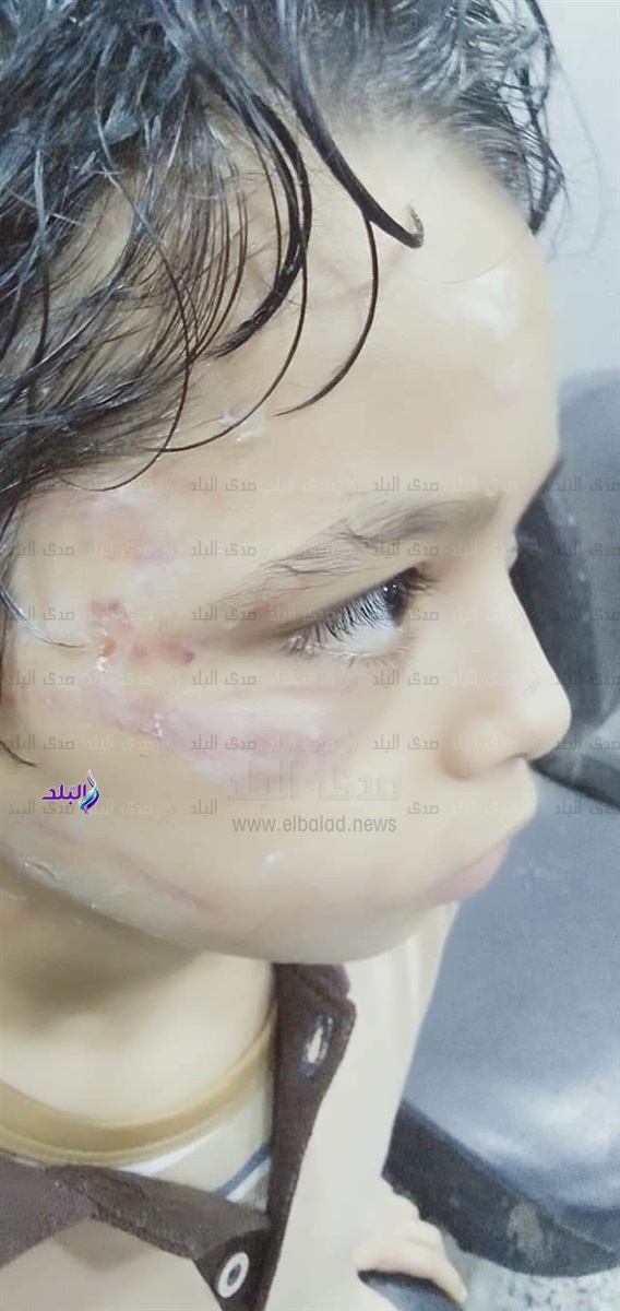 الطفل المعتدى عليه الطفل المعتدى عليه