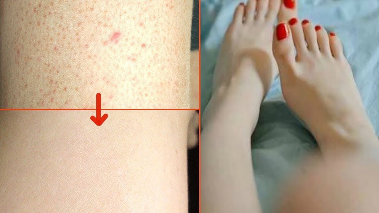 حيلة سهلة للتخلص من جلد الوزة