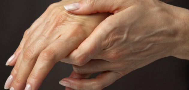 مرض نادر .. اكتشف أعراض خلل التوتر العضلي