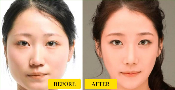 منها مضغ العلكة... طرق سريعة للتخلص من الخدود الممتلئة 