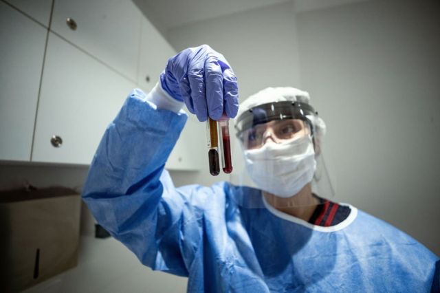 مركز بلازما الدم