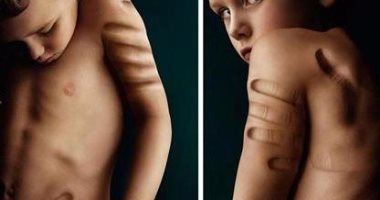 تعذيب الأطفال 