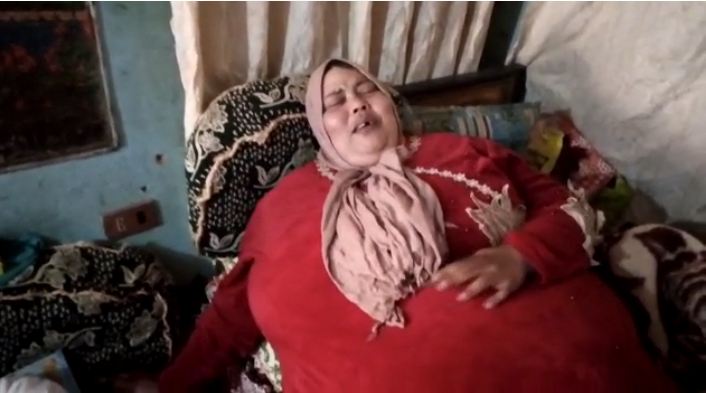 شيرين تعاني من داء الفيل