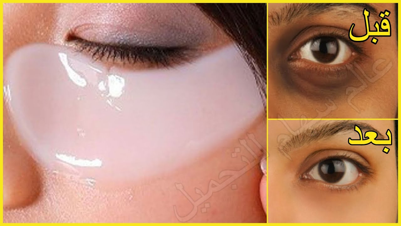 وصفة دقيق الأرز علاج فعال للهالات السوداء ليلة رأس السنة 