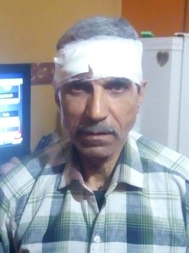 السائق المصاب 