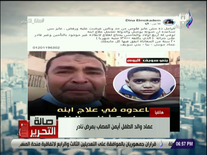 طفل مصاب بمرض نادر 