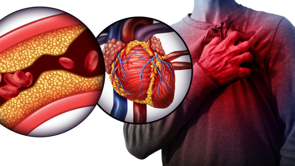  نوع من البقوليات مفيد لمرضى الكوليسترول