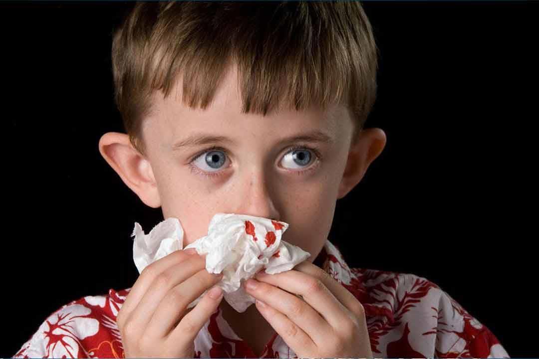 مرض خطير .. اكتشف اعراض الهيموفيليا
