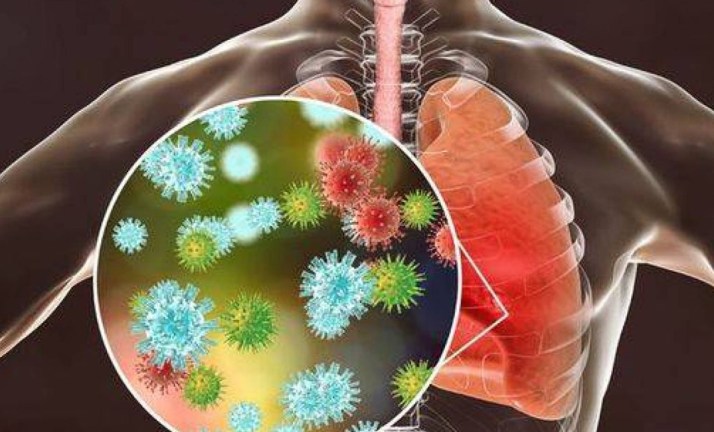 عشان تبقي في امان .. اليك علاج الالتهاب الرئوي وطرق الوقاية