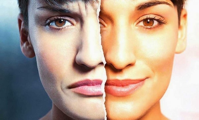 أعراض الهوس