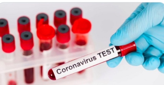 إصابات كورونا  - ارشيفي  إصابات كورونا  - ارشيفي