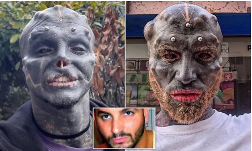  أنتوني لوفريدو قبل وبعد عمليات التجميل