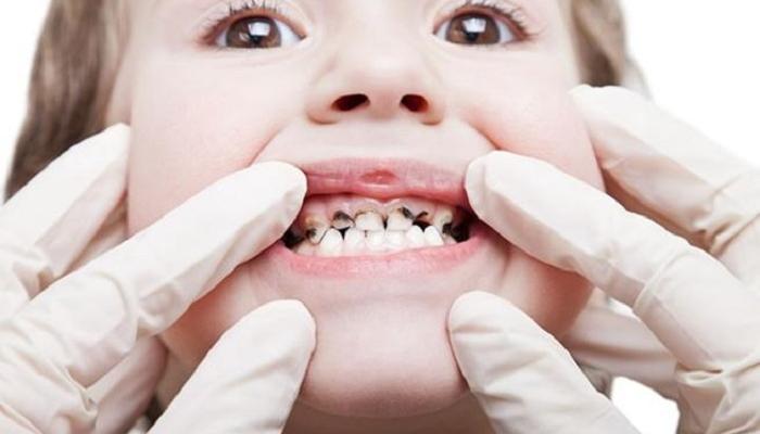 ماذا تفعل الماء في أسنان طفلك ؟