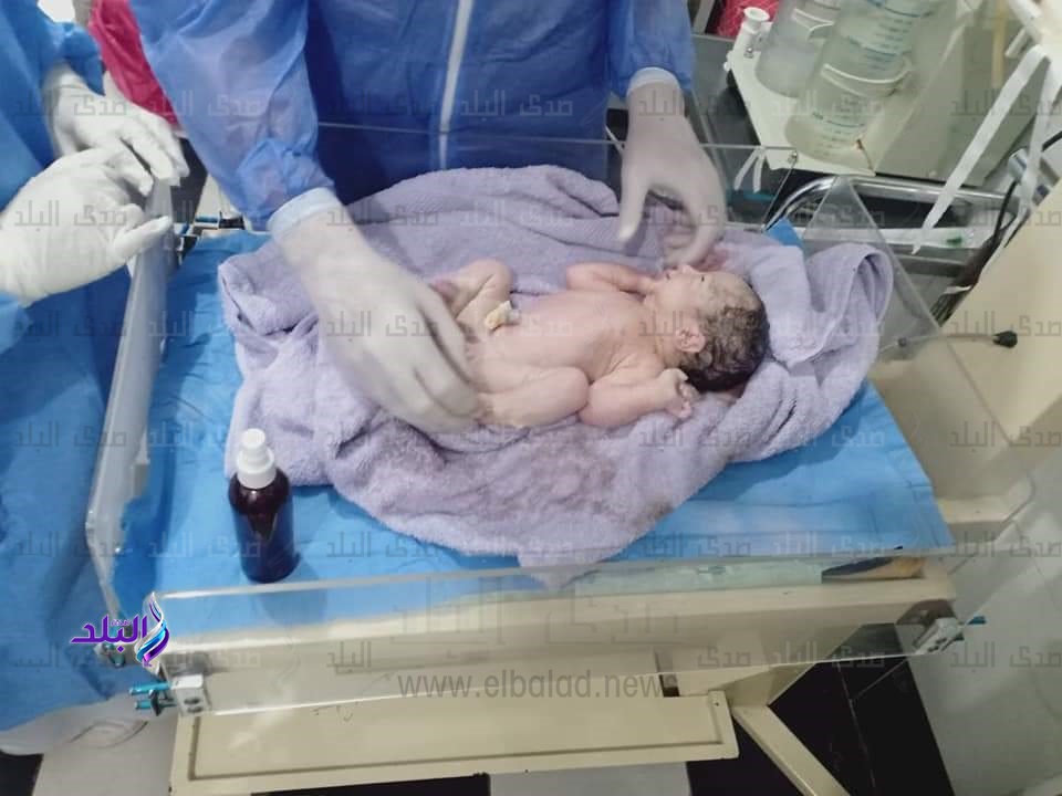 مستشفي الوقف ينجح في إجراء عملية ولادة لسيدة مصابة بالكورونا
