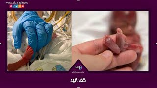 أغرب ولادة