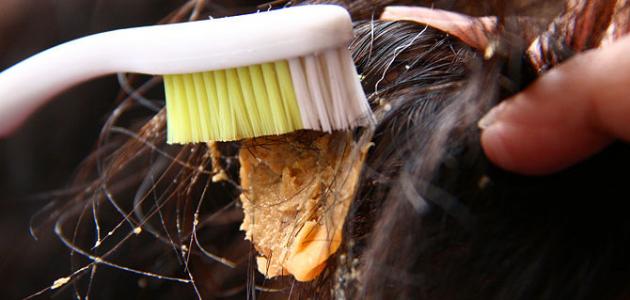 إزاي تتصرفي لو لزقت لبانة في شعر طفلك