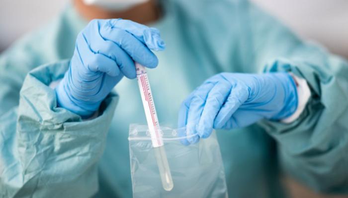 كورونا كورونا