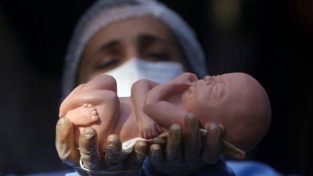 دار الإفتاء: الاجهاض بعد نفخ الروح في الجنين حرام إلا بمبرر 