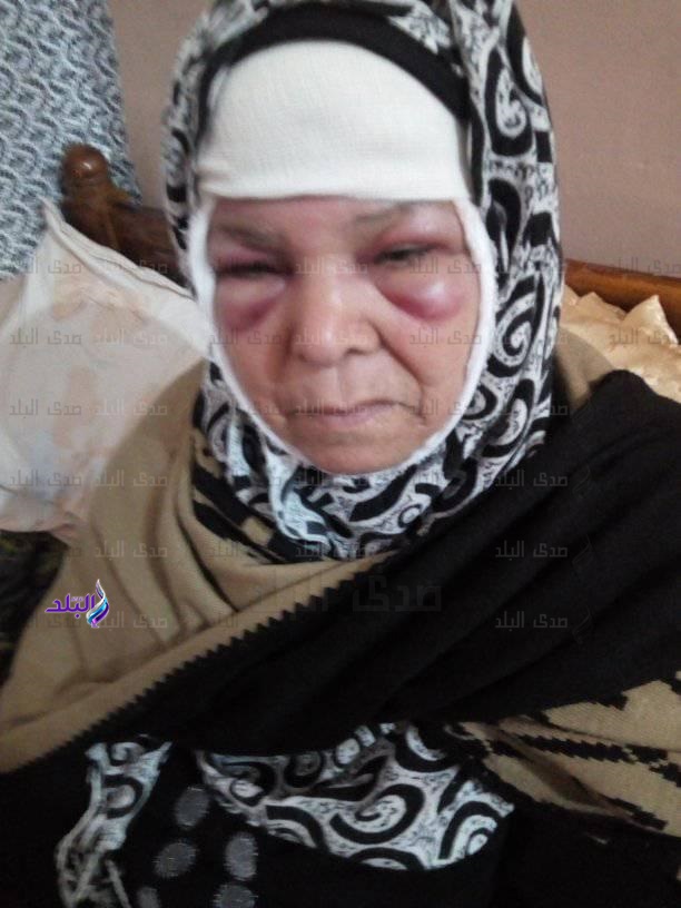 السيدة المجنى عليه 