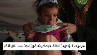  الجوع يفتك بأطفال المخيمات